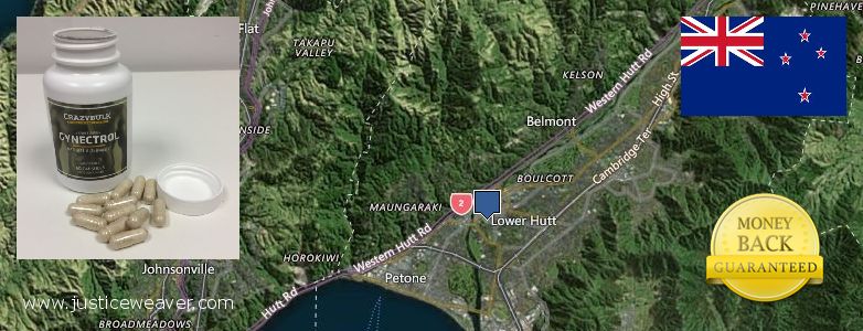 Recomended Gynecomastia Surgery  Lower Hutt, New Zealand