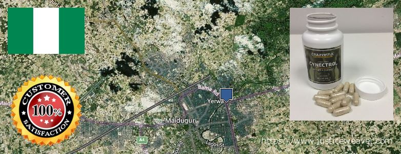 Gynecomastia Surgery Maiduguri, Nigeria Gynecomastia Surgery Maiduguri, Nigeria